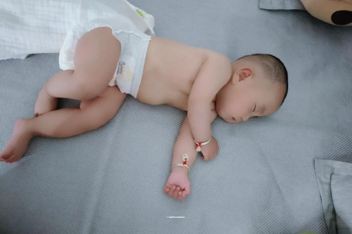 河间宝宝头上长痱子